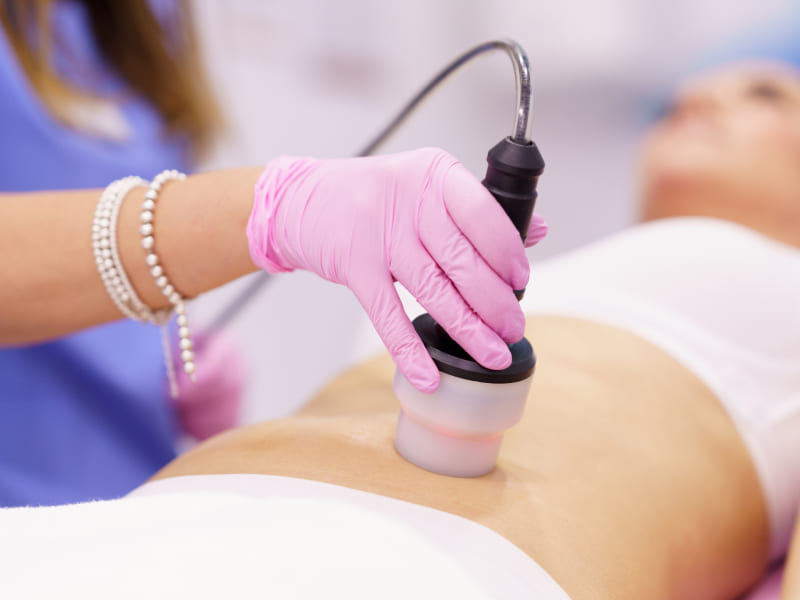 CoolSculpting