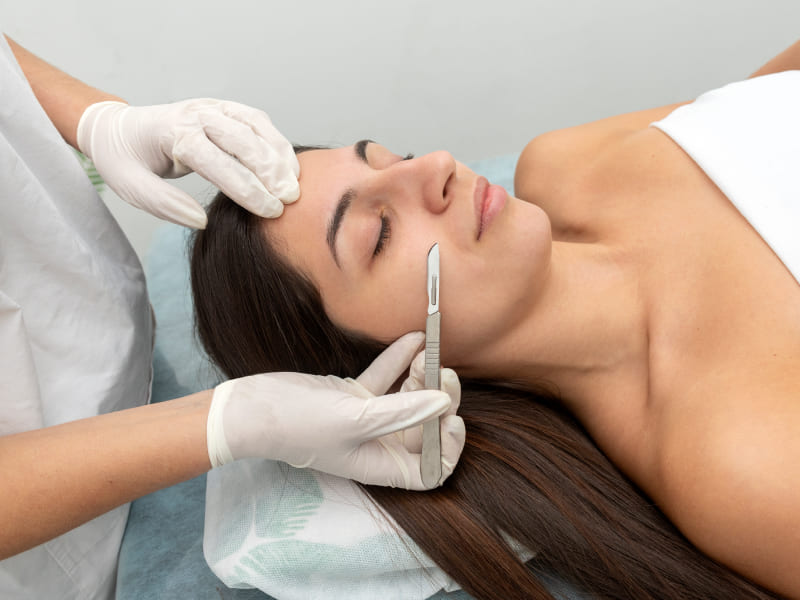 Dermaplaning