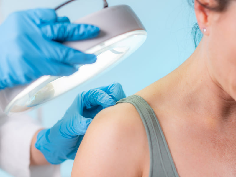 Phototherapy for Psoriasis