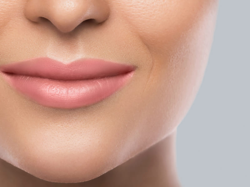 Restylane
